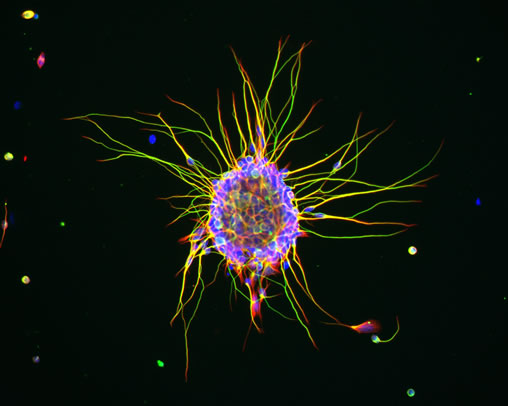 Nerve Cells in the Brain